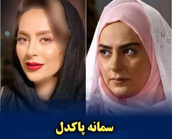 عکس سمانه پاکدل قبل و بعد از عمل