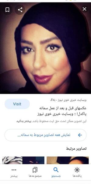 عکس سمانه پاکدل قبل و بعد از عمل