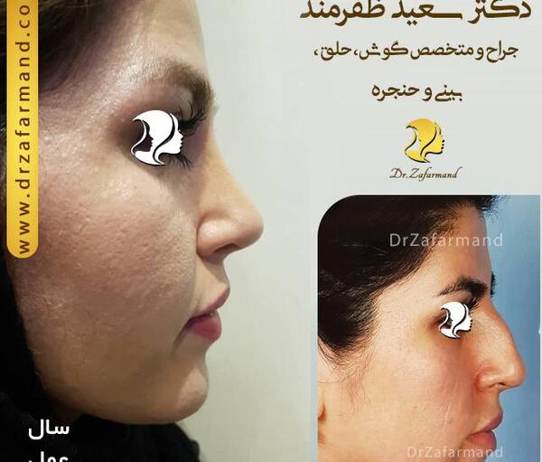 عکس عمل بینی دکتر سعید فلاحتی