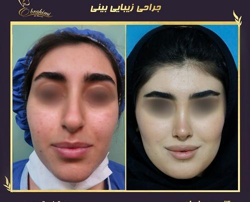 عکس عمل بینی دکتر سعید فلاحتی