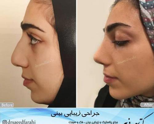 عکس عمل بینی دکتر سعید فلاحتی