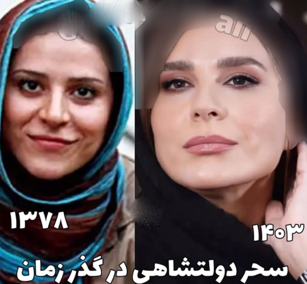 عکس سحر مقدس قبل از عمل