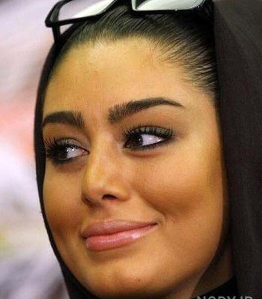 عکس سحر مقدس قبل از عمل