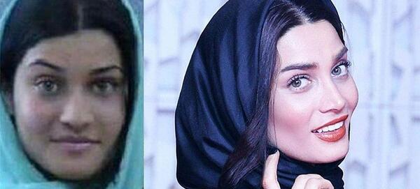 عکس سحر مقدس قبل از عمل