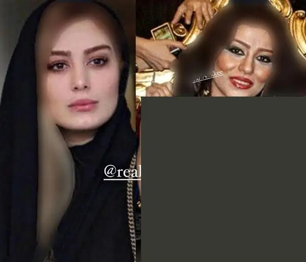 عکس سحر مقدس قبل از عمل