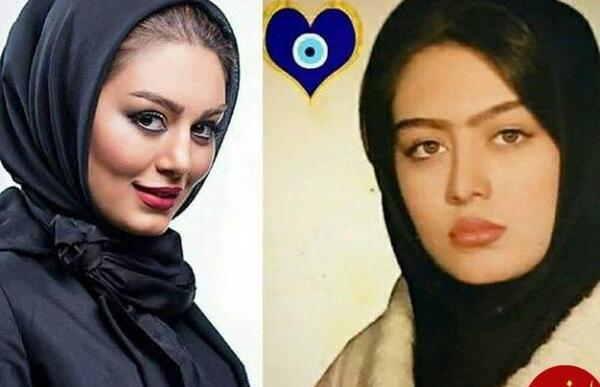 عکس سحر مقدس قبل از عمل