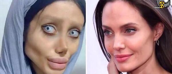 عکس سحر مقدس قبل از عمل