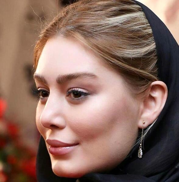 عکس از سحر قریشی قبل عمل