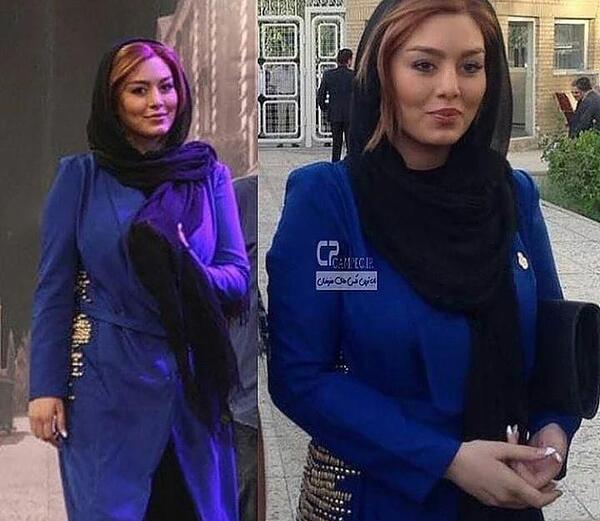 عکس از سحر قریشی قبل عمل