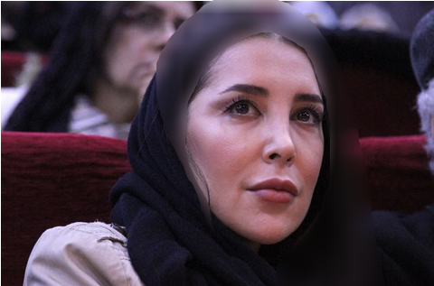 عکس سحر جوزانی بعد از عمل فک