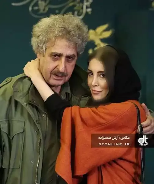عکس سحر جوزانی بعد از عمل فک