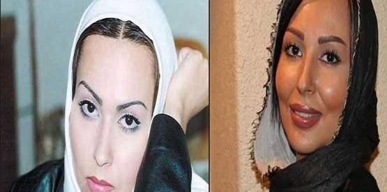 عکس سحر جوزانی بعد از عمل فک