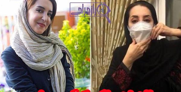 عکس سحر جوزانی بعد از عمل فک