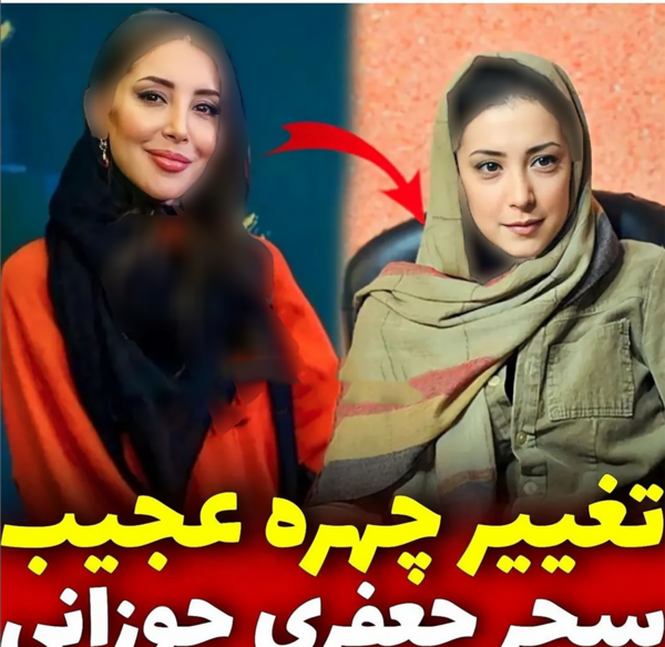عکس سحر جوزانی بعد از عمل فک