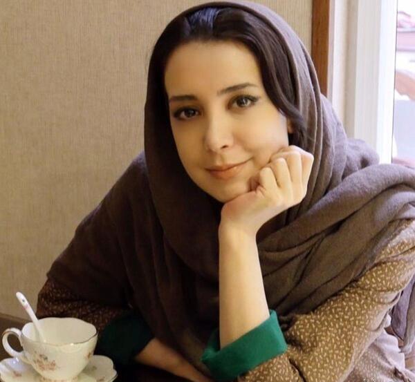عکس سحر جوزانی بعد از عمل فک