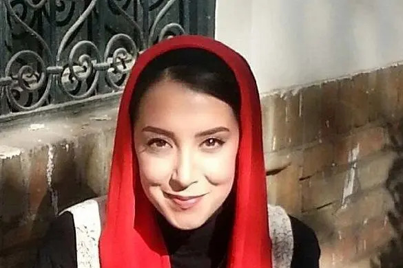 عکس سحر جوزانی بعد از عمل فک