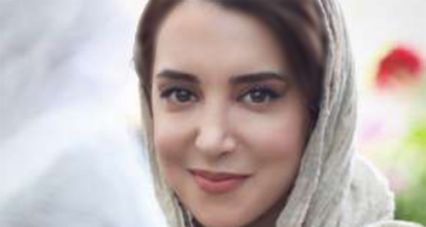 عکس سحر جوزانی بعد از عمل فک