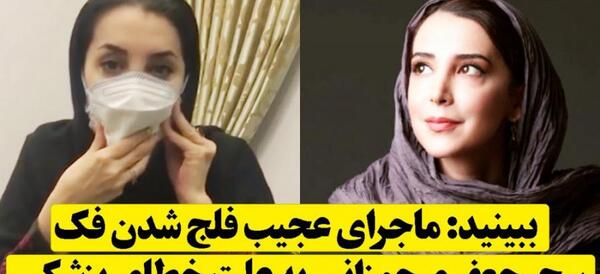 عکس سحر جوزانی بعد از عمل فک