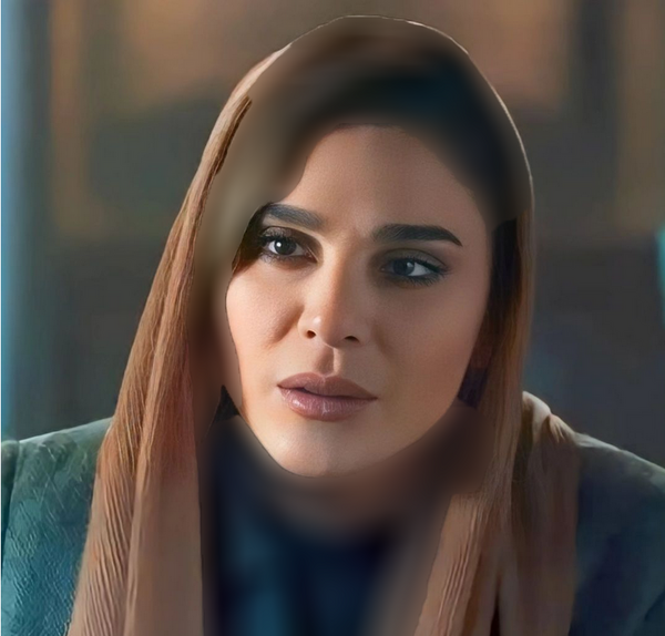 عکس سحر دولتشاهی قبل از عمل