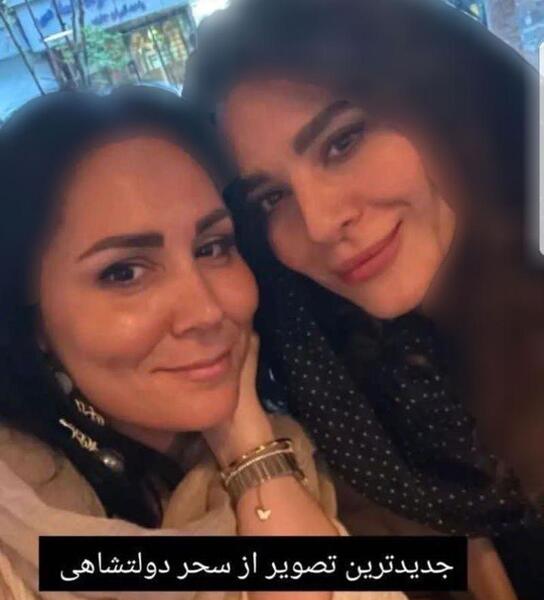 عکس سحر دولتشاهی قبل از عمل