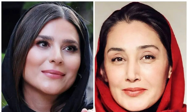 عکس سحر دولتشاهی قبل از عمل