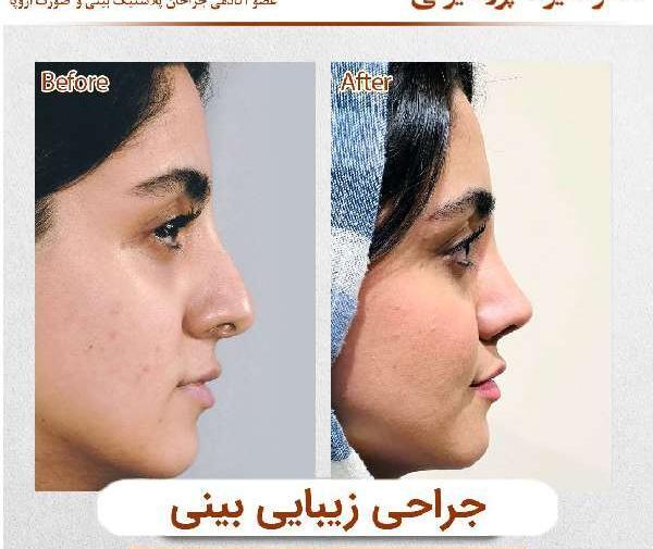 عکس صورت زیبا زنان