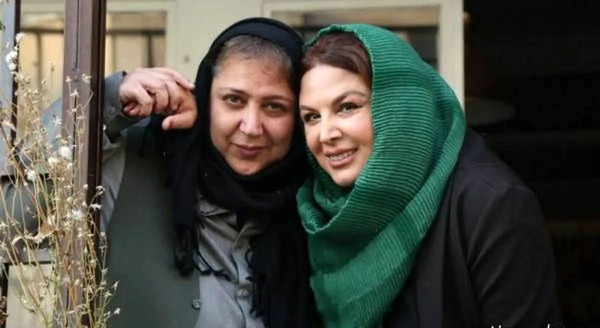 عکس شهره لرستانی قبل و بعد عمل