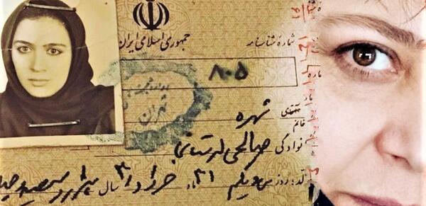 عکس شهره لرستانی قبل و بعد عمل