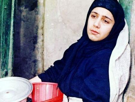 عکس شهره لرستانی قبل و بعد از عمل