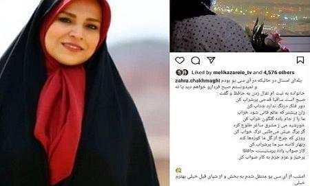 عکس زهرا چخماقی قبل و بعد عمل