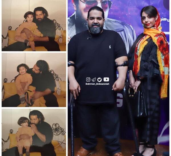 عکس رضا صادقی بعد از عمل اسلیو