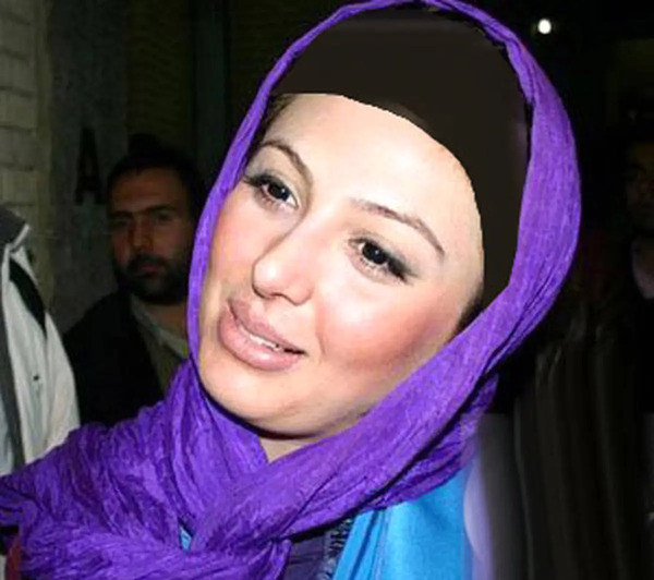 عکس های نیوشا ضیغمی قبل از عمل