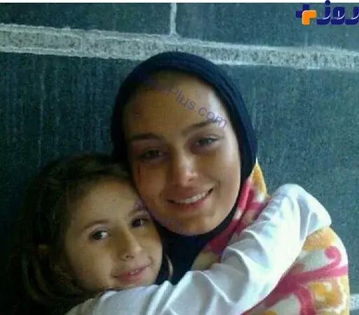 عکس های سحر قریشی قبل از عمل