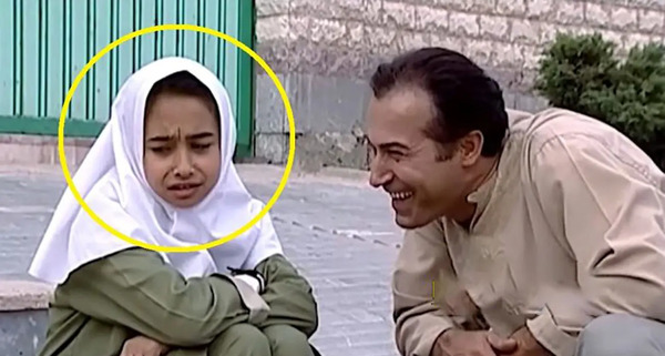 عکس دانیال حکیمی قبل و بعد از عمل بینی
