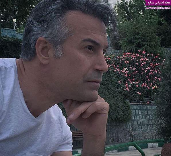 عکس دانیال حکیمی قبل و بعد از عمل بینی