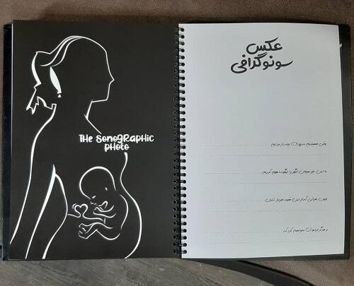 آلبوم عکس خاطرات کودک