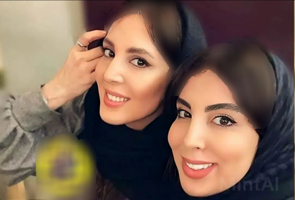 عکس خواهر دوقلوی کیسان دیباج