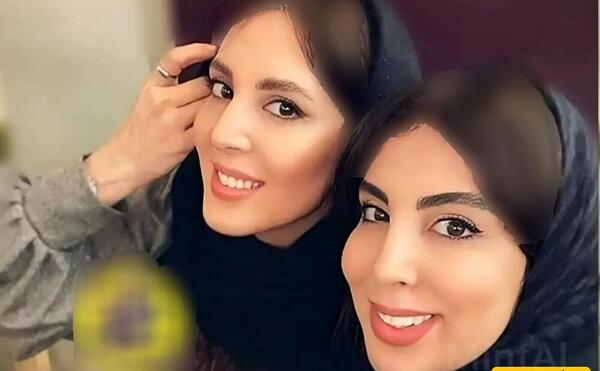 عکس خواهر دوقلو کیسان دیباج