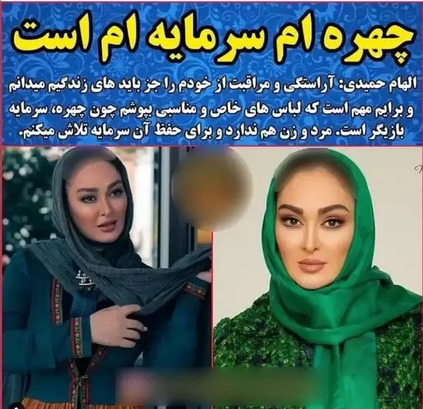 عکس الهام حمیدی قبل و بعد عمل