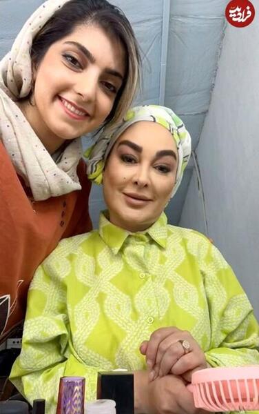عکس الهام حمیدی قبل و بعد عمل