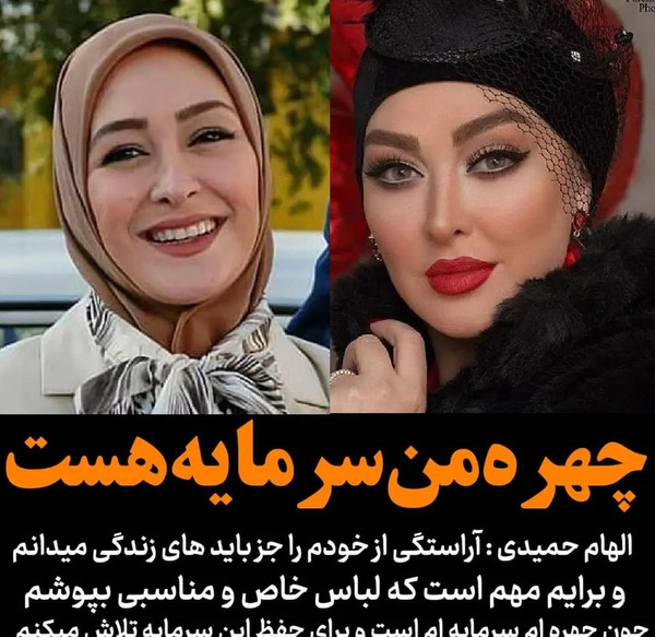عکس الهام حمیدی قبل و بعد عمل