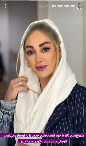 عکس الهام حمیدی قبل و بعد عمل
