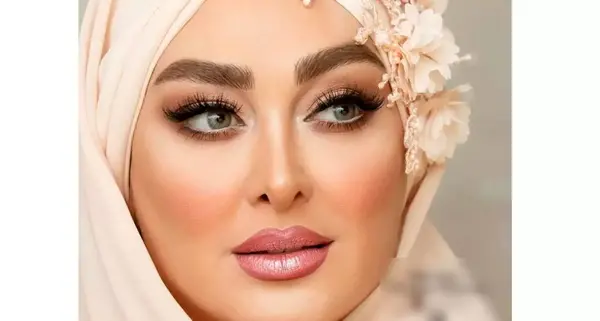 عکس الهام حمیدی قبل و بعد عمل