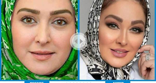 عکس الهام حمیدی قبل و بعد عمل