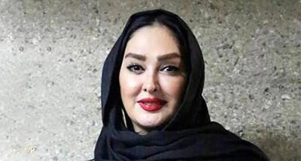 عکس الهام حمیدی قبل و بعد عمل