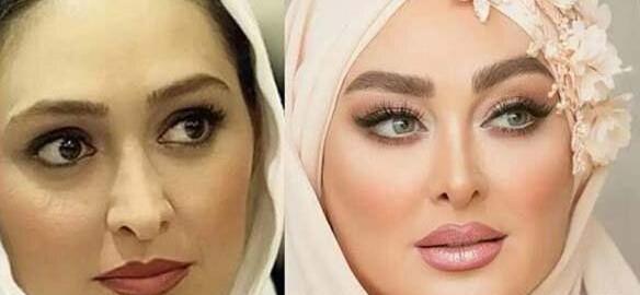 عکس الهام حمیدی قبل و بعد عمل