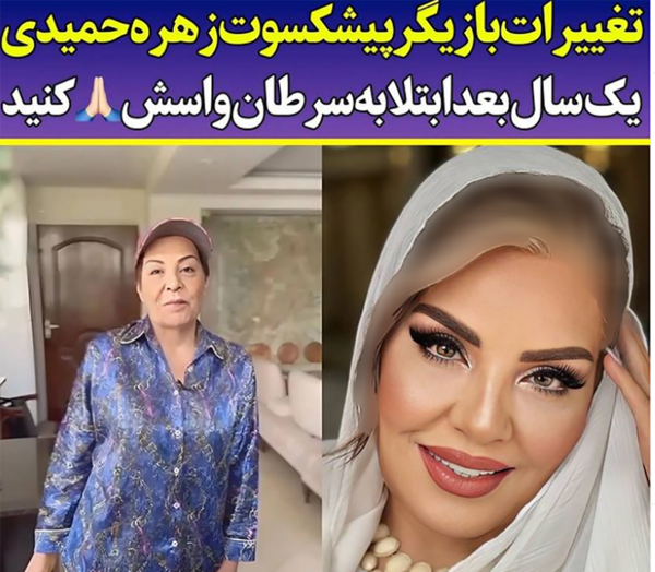 عکس زهره حمیدی بعد از عمل زیبایی