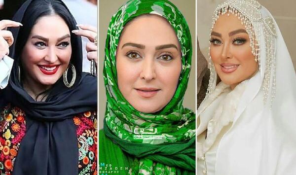 عکس زهره حمیدی بعد از عمل زیبایی