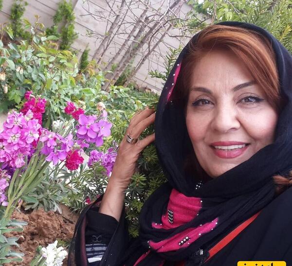 عکس زهره حمیدی بعد از عمل زیبایی