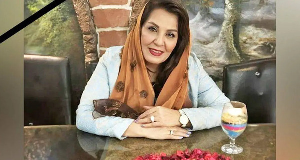 عکس زهره حمیدی بعد از عمل زیبایی
